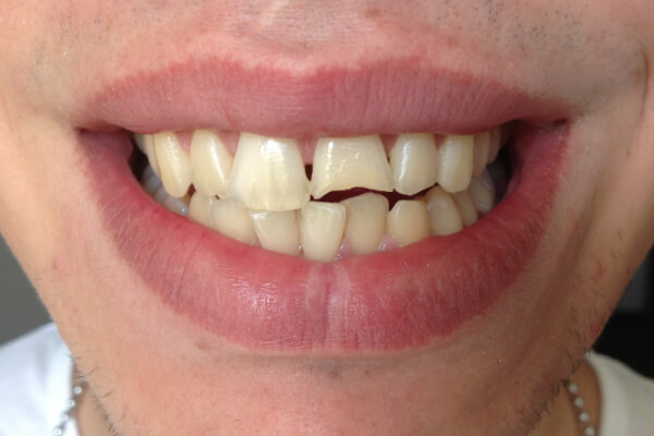 Weyand Dental Labor - Homburg - Zahnästhetik